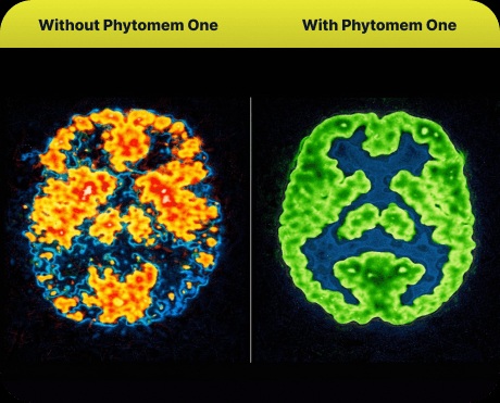 Brain Scan Before and After Phytomemone Support